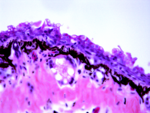 Section histologique de peau d'amphibien atteint de chytridiomycose, maladie à l'origine du déclin de nombreuses espèces d'amphibiens.